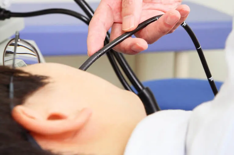 胃カメラ検査(胃内視鏡検査)について